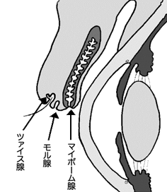 まつ毛の付け根辺りにできてしまう 白いポツっとしたものはなに 視力改善ポータルeye